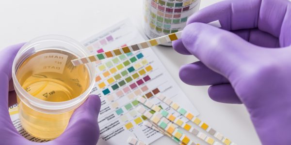 Infecção urinária: conheça as principais causas e previna-se