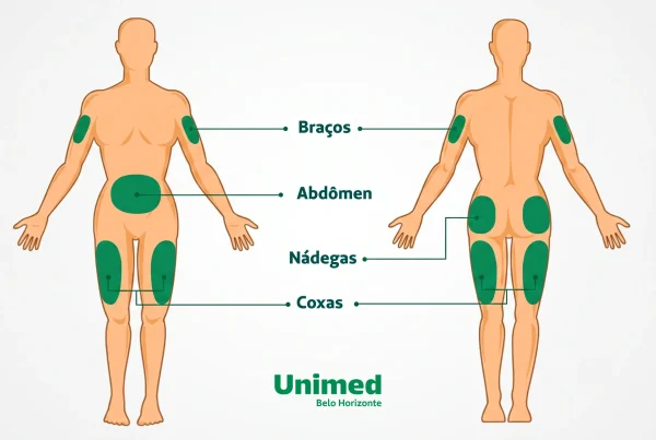 Representação visual das áreas de aplicação da insulina