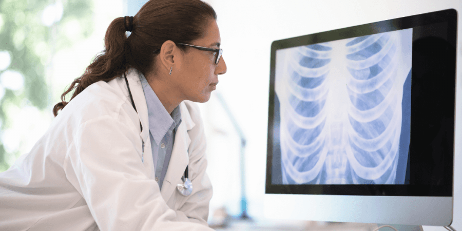 DPOC sintomas: sinais de exacerbação da doença pulmonar obstrutiva
