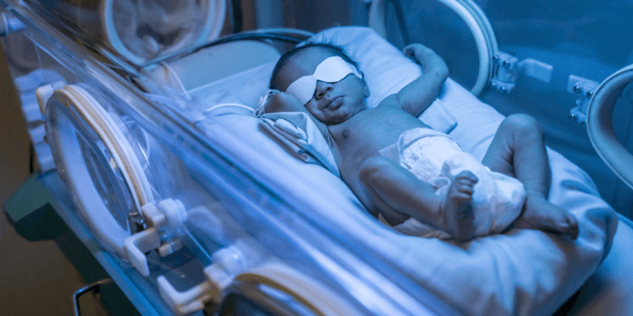Saiba mais sobre Icterícia neonatal: sintomas, riscos e tratamento