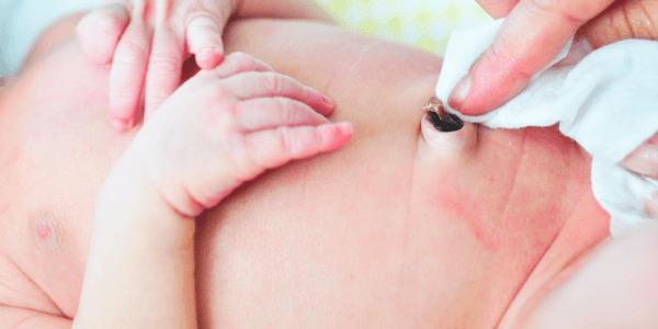 Coto umbilical: o que é e como cuidar?