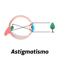 refração ocular - astigmatismo 