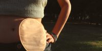 Ostomia de eliminação: tipos, causas e principais cuidados