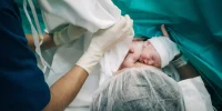Sala de parto: primeiros cuidados com o recém-nascido