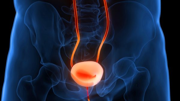Câncer de bexiga: sintomas, diagnóstico e tratamento