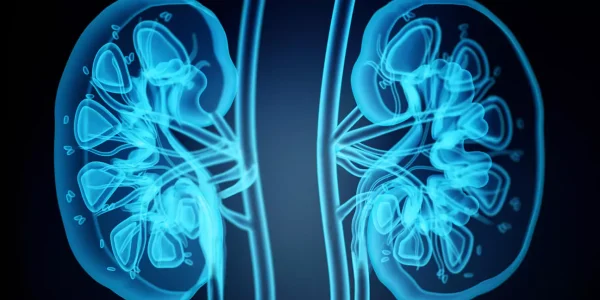 Doença Renal Policística: o que é, sintomas e tratamentos